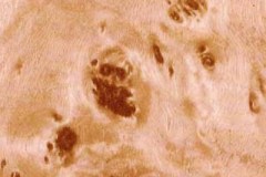 HW-38-2